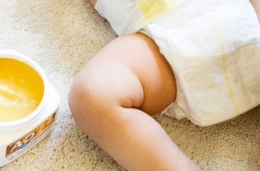 Diaper Rash Creams