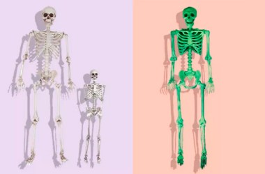 Oversized Skeletons