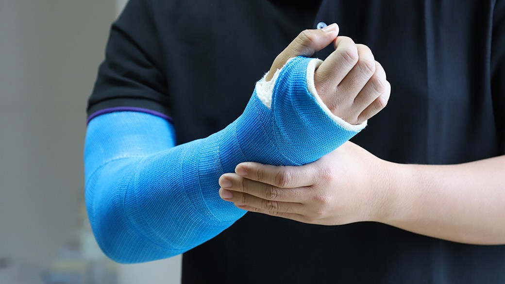 Best adult arm cast cover