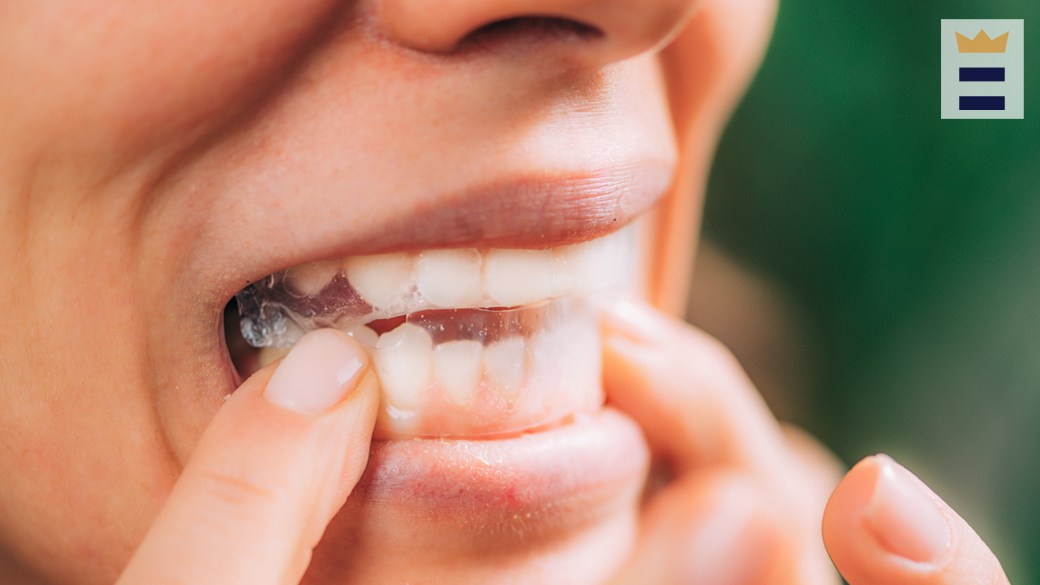 Teeth whitening kits vs. strips Which should I get?